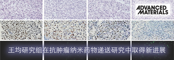 王均研究组在抗肿瘤纳米药物递送研究中取得新进展