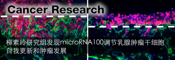 中国科大研究发现microRNA100调节乳腺肿瘤干细胞自我更新和肿瘤发展