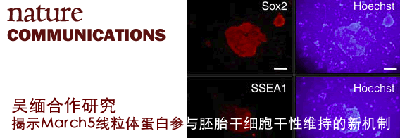 中国科大在胚胎干细胞研究中取得新进展