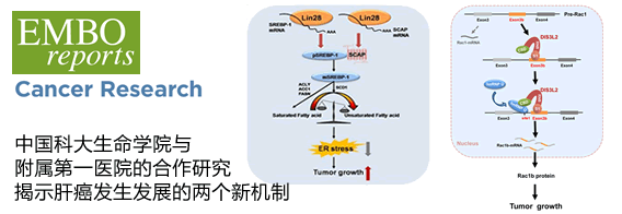 中国科大生命学院与附属第一医院的合作研究揭示肝癌发生发展的两个新机制